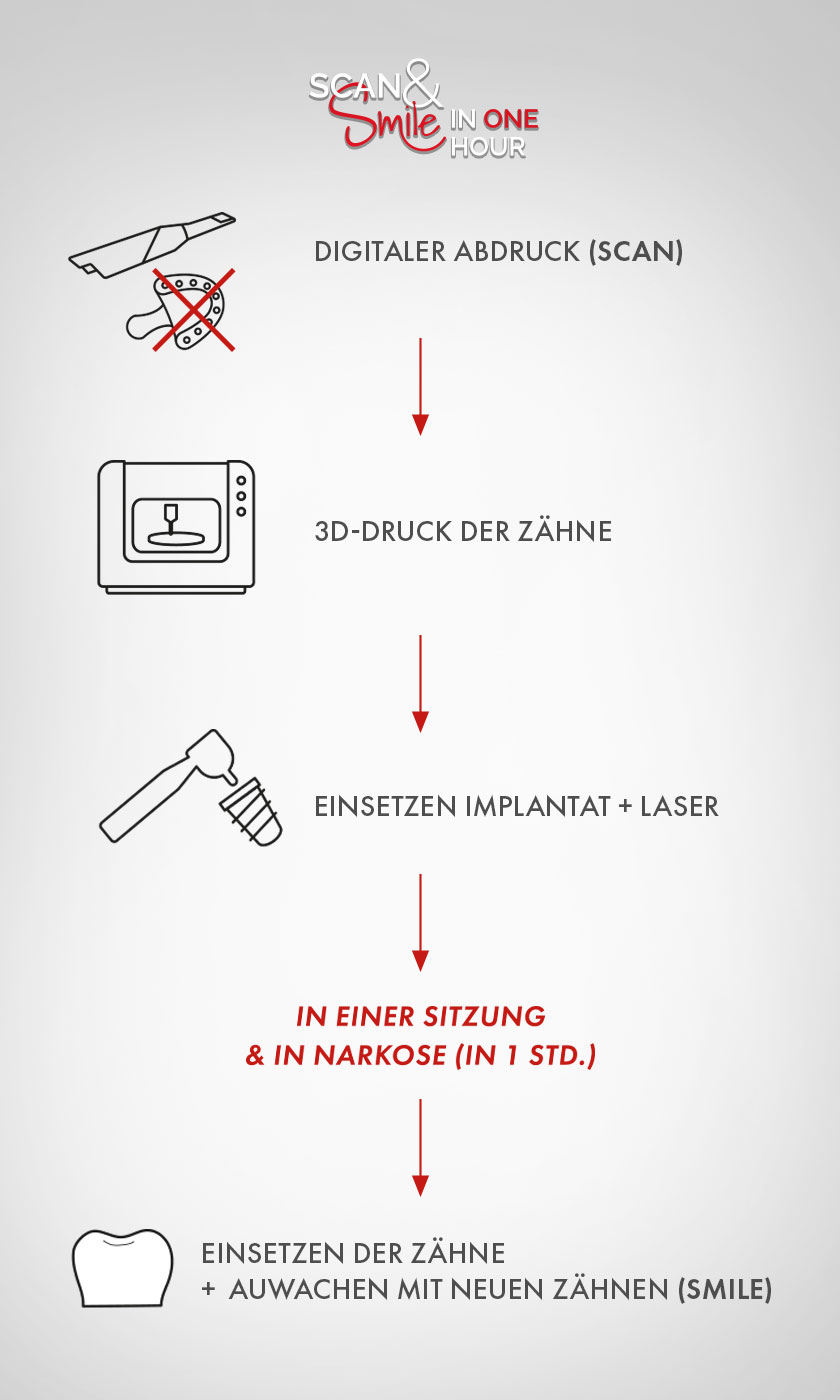 Grafik des Behandlungsablaufs von Scan&Smile: Digitaler Abdruck, 3D-Druck der Zähne, Einsetzen Implantat & Laser, Einsetzen der Zähne und Aufwachen mit neuen Zähnen (Smile)