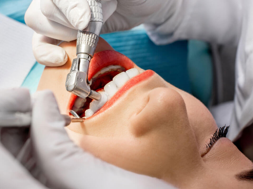 Grossaufnahme einer Frau, die sich gerade die Zähne beim Zahnarzt polieren lässt